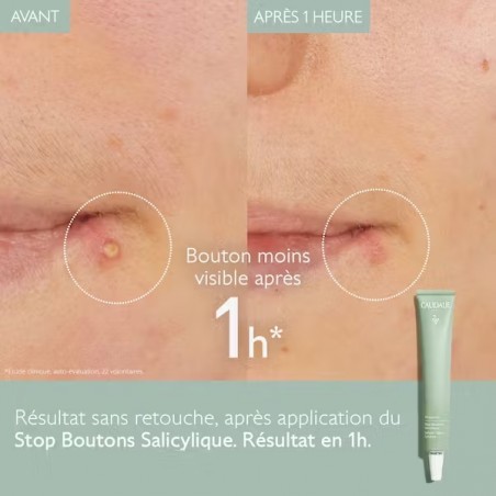 CAUDALIE VINOPURE Stop Boutons Salicylique | 15 ml