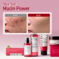 SOME BY MI SNAIL TRUECICA MIRACLE REPAIR CREAM | 60G SOME BY MI SNAIL TRUECICA MIRACLE REPAIR CREAM | 60G