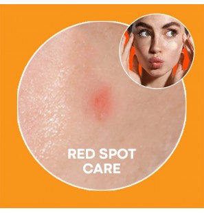 NOLAHOUR SPOT ERASER ORANGE PATCHES B12