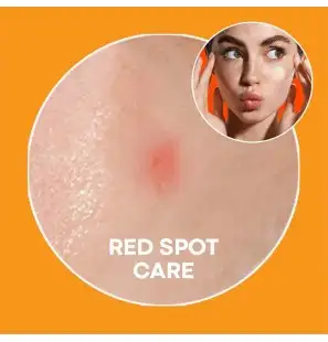 NOLAHOUR SPOT ERASER ORANGE PATCHES B12